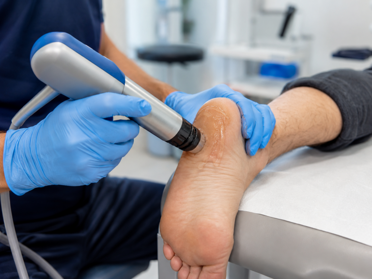 Close-up of a clinician applying a radial shockwave applicator to a patient's heel for plantar fasciitis, gel visible on skin